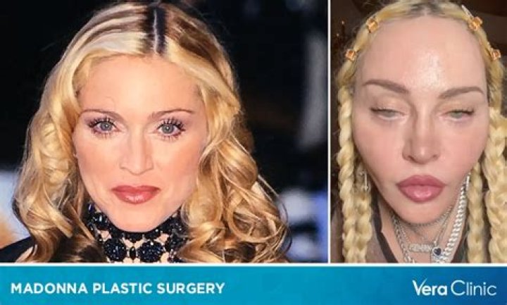 Inside Details: Lauren Boebert's Rumored Plastic Surgery
